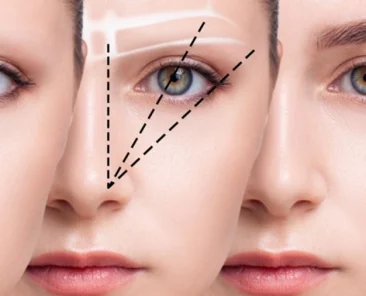 FUT-Augenbrauentransplantation Nackennarbe: 3 Unterschiede der nahtlosen Entfernung