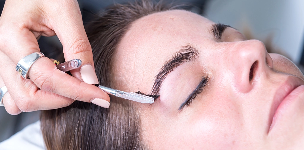 Graft Selection in Eyebrow Transplantation: 4 Fine Grafts Suitable for the Eyebrows